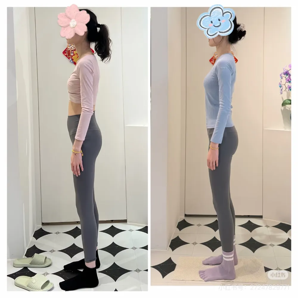 学员体态改善前后对比照(之二)