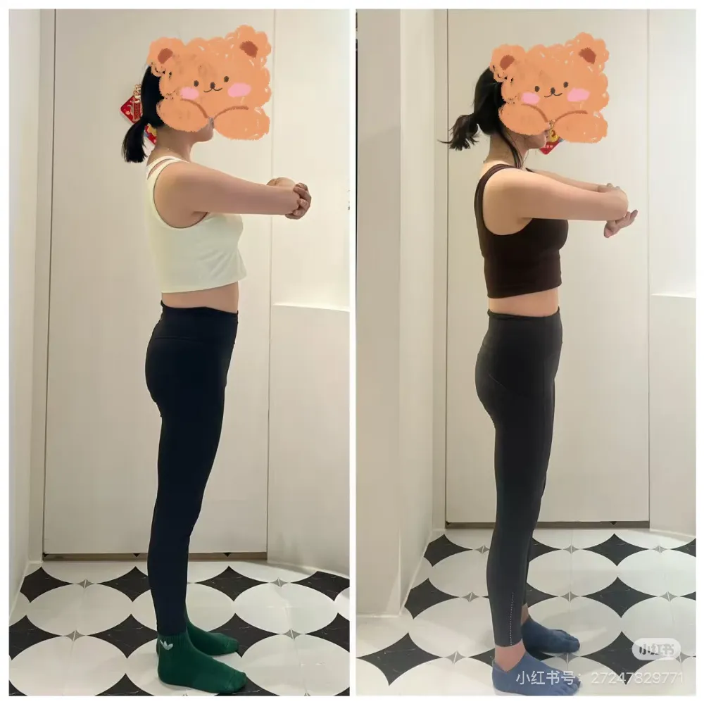 学员体态改善前后对比照(之三)